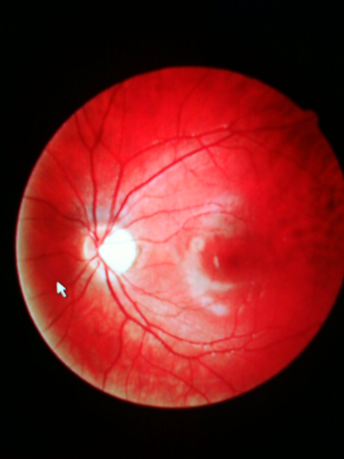 retina.jpg